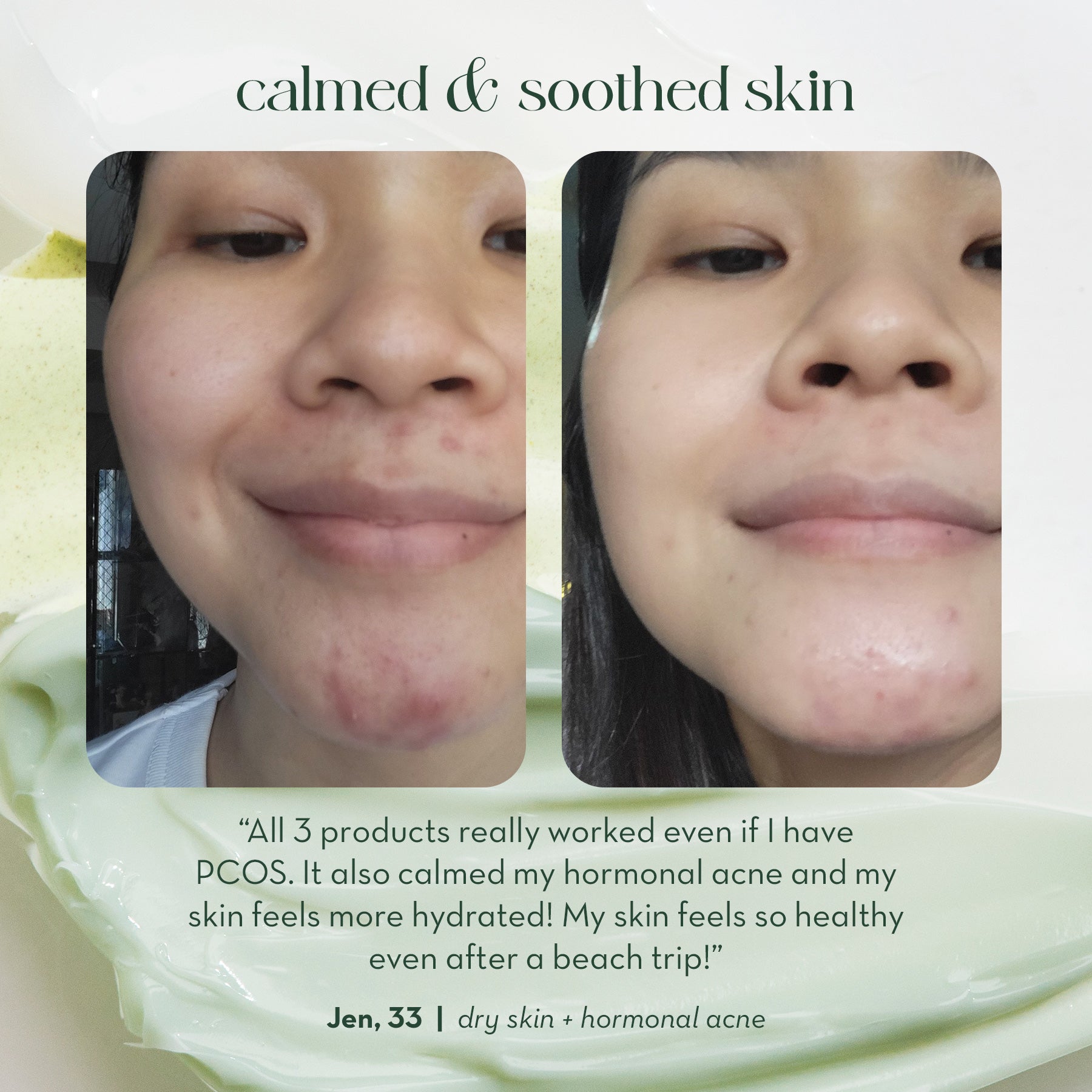 Happy Skin Calm & Soothe Skincare Boosters Full Set (Spot Corrector + Glow Drops + Overnight Cream + Pimple Patch)